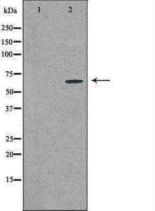 CSTF2T Antibody - Western blot analysis of extracts of MCF-7 cells using CSTF2T antibody. The lane on the left is treated with the antigen-specific peptide.