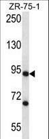 CSTF3 Antibody - CSTF3 Antibody western blot of ZR-75-1 cell line lysates (35 ug/lane). The CSTF3 antibody detected the CSTF3 protein (arrow).
