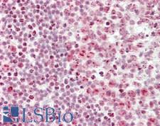 CSTF3 Antibody - Human Tonsil: Formalin-Fixed, Paraffin-Embedded (FFPE).  This image was taken for the unconjugated form of this product. Other forms have not been tested.