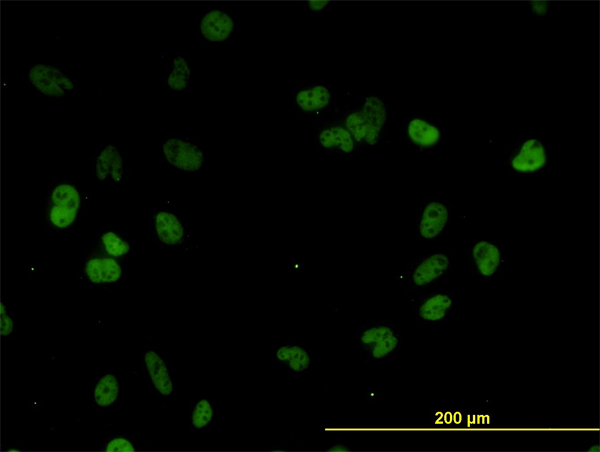 CSTF3 Antibody - Immunofluorescence of monoclonal antibody to CSTF3 on HeLa cell. [antibody concentration 10 ug/ml]