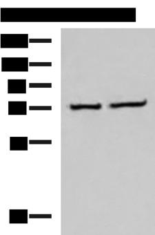 CSTF3 Antibody - Western blot analysis of K562 and Jurkat cell lysates  using CSTF3 Polyclonal Antibody at dilution of 1:650