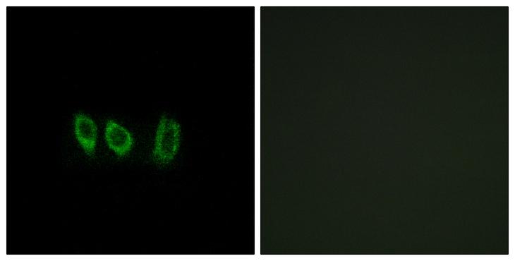 CSTL1 / Cystatin-Like 1 Antibody - Peptide - + Immunofluorescence analysis of A549 cells, using CSTL1 antibody.