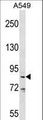 CT26 / DDX53 Antibody - DDX53 Antibody western blot of A549 cell line lysates (35 ug/lane). The DDX53 antibody detected the DDX53 protein (arrow).