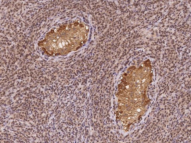 CT26 / DDX53 Antibody - Immunochemical staining of human DDX53 in human testis with rabbit polyclonal antibody at 1:100 dilution, formalin-fixed paraffin embedded sections.