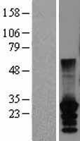 CT45A2 Protein - Western validation with an anti-DDK antibody * L: Control HEK293 lysate R: Over-expression lysate