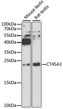 CT45A3 Antibody - Western blot analysis of extracts of various cell lines, using CT45A3 antibody at 1:3000 dilution. The secondary antibody used was an HRP Goat Anti-Rabbit IgG (H+L) at 1:10000 dilution. Lysates were loaded 25ug per lane and 3% nonfat dry milk in TBST was used for blocking. An ECL Kit was used for detection and the exposure time was 90s.