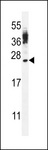 CT45A4 Antibody - CT45A Antibody western blot of WiDr cell line lysates (35 ug/lane). The CT45A antibody detected the CT45A protein (arrow).