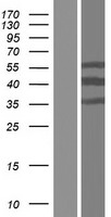 CT47A2 Protein - Western validation with an anti-DDK antibody * L: Control HEK293 lysate R: Over-expression lysate