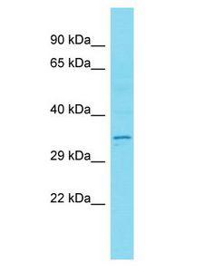 CT47B1 Antibody - CT47B1 antibody Western Blot of Placenta. Antibody dilution: 1 ug/ml.  This image was taken for the unconjugated form of this product. Other forms have not been tested.