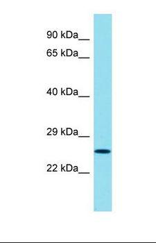 CT55 / CXorf48 Antibody - Western blot of Human HT1080. CXorf48 antibody dilution 1.0 ug/ml.  This image was taken for the unconjugated form of this product. Other forms have not been tested.