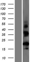 CT62 Protein - Western validation with an anti-DDK antibody * L: Control HEK293 lysate R: Over-expression lysate