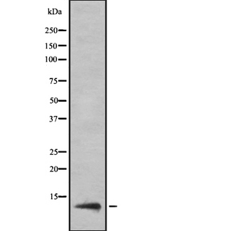 CT83 / CXorf61 Antibody - Western blot analysis of KKLC1 using HepG2 whole cells lysates