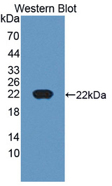 CTAG1B / NY-ESO-1 Antibody - Western blot of CTAG1B / NY-ESO-1 antibody.