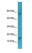 CTAG1B / NY-ESO-1 Antibody - CTAG1B / NY-ESO-1 antibody Western Blot of Fetal Stomach.  This image was taken for the unconjugated form of this product. Other forms have not been tested.