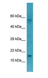 CTAG1B / NY-ESO-1 Antibody - CTAG1B / NY-ESO-1 antibody Western Blot of Fetal Stomach.  This image was taken for the unconjugated form of this product. Other forms have not been tested.
