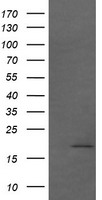 CTAG1B / NY-ESO-1 Antibody - HEK293T cells were transfected with the pCMV6-ENTRY control (Left lane) or pCMV6-ENTRY CTAG1B (Right lane) cDNA for 48 hrs and lysed. Equivalent amounts of cell lysates (5 ug per lane) were separated by SDS-PAGE and immunoblotted with anti-CTAG1B.