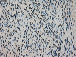 CTAG1B / NY-ESO-1 Antibody - IHC of paraffin-embedded Ovary tissue using anti-CTAG1B mouse monoclonal antibody. (Dilution 1:50).