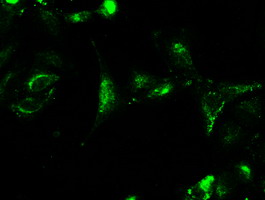 CTAG1B / NY-ESO-1 Antibody - Immunofluorescent staining of A549 cells using anti-CTAG1B mouse monoclonal antibody.