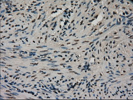 CTAG1B / NY-ESO-1 Antibody - IHC of paraffin-embedded endometrium tissue using anti-CTAG1B mouse monoclonal antibody. (Dilution 1:50).