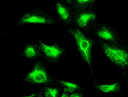 CTAG1B / NY-ESO-1 Antibody - Immunofluorescent staining of A549 cells using anti-CTAG1B mouse monoclonal antibody.