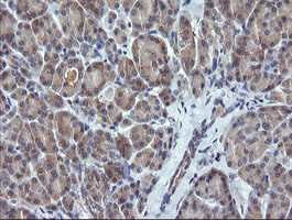 CTAG1B / NY-ESO-1 Antibody - IHC of paraffin-embedded Human pancreas tissue using anti-CTAG1B mouse monoclonal antibody. (Heat-induced epitope retrieval by 10mM citric buffer, pH6.0, 120°C for 3min).