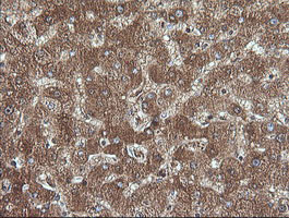 CTAG1B / NY-ESO-1 Antibody - IHC of paraffin-embedded Human liver tissue using anti-CTAG1B mouse monoclonal antibody.