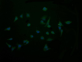 CTAG1B / NY-ESO-1 Antibody - Immunofluorescent staining of HeLa cells using anti-CTAG1B mouse monoclonal antibody.