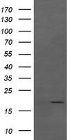 CTAG1B / NY-ESO-1 Antibody - HEK293T cells were transfected with the pCMV6-ENTRY control (Left lane) or pCMV6-ENTRY CTAG1B (Right lane) cDNA for 48 hrs and lysed. Equivalent amounts of cell lysates (5 ug per lane) were separated by SDS-PAGE and immunoblotted with anti-CTAG1B.