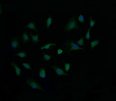 CTAG1B / NY-ESO-1 Antibody - Immunofluorescent staining of HeLa cells using anti-CTAG1B mouse monoclonal antibody.