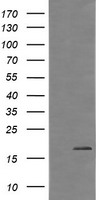 CTAG1B / NY-ESO-1 Antibody - HEK293T cells were transfected with the pCMV6-ENTRY control (Left lane) or pCMV6-ENTRY CTAG1B (Right lane) cDNA for 48 hrs and lysed. Equivalent amounts of cell lysates (5 ug per lane) were separated by SDS-PAGE and immunoblotted with anti-CTAG1B.