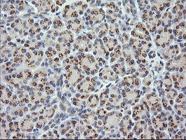 CTAG1B / NY-ESO-1 Antibody - IHC of paraffin-embedded Human pancreas tissue using anti-CTAG1B mouse monoclonal antibody.