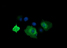 CTAG1B / NY-ESO-1 Antibody - Anti-CTAG1B mouse monoclonal antibody immunofluorescent staining of COS7 cells transiently transfected by pCMV6-ENTRY CTAG1B.