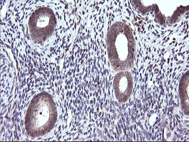 CTAG1B / NY-ESO-1 Antibody - IHC of paraffin-embedded Human endometrium tissue using anti-CTAG1B mouse monoclonal antibody.