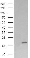 CTAG1B / NY-ESO-1 Antibody - HEK293T cells were transfected with the pCMV6-ENTRY control (Left lane) or pCMV6-ENTRY CTAG1B (Right lane) cDNA for 48 hrs and lysed. Equivalent amounts of cell lysates (5 ug per lane) were separated by SDS-PAGE and immunoblotted with anti-CTAG1B.