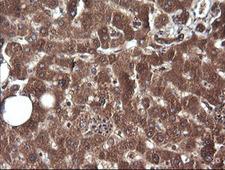 CTAG1B / NY-ESO-1 Antibody - IHC of paraffin-embedded Human liver tissue using anti-CTAG1B mouse monoclonal antibody.