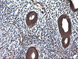 CTAG1B / NY-ESO-1 Antibody - IHC of paraffin-embedded Human endometrium tissue using anti-CTAG1B mouse monoclonal antibody.