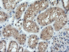 CTAG1B / NY-ESO-1 Antibody - IHC of paraffin-embedded Human Kidney tissue using anti-CTAG1B mouse monoclonal antibody.