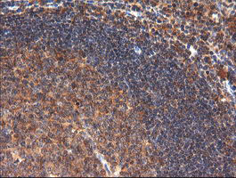 CTAG1B / NY-ESO-1 Antibody - IHC of paraffin-embedded Human tonsil using anti-CTAG1B mouse monoclonal antibody.