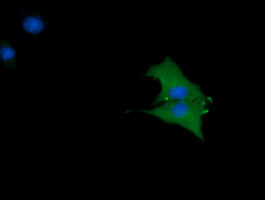 CTAG1B / NY-ESO-1 Antibody - Anti-CTAG1B mouse monoclonal antibody immunofluorescent staining of COS7 cells transiently transfected by pCMV6-ENTRY CTAG1B.