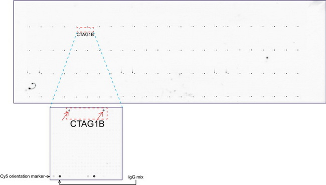 CTAG1B / NY-ESO-1 Antibody - OriGene overexpression protein microarray chip was immunostained with UltraMAB anti-CTAG1B mouse monoclonal antibody. The positive reactive proteins are highlighted with two red arrows in the enlarged subarray. All the positive controls spotted in this subarray are also labeled for clarification.