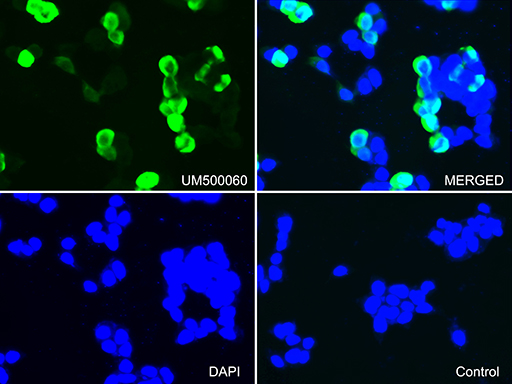 CTAG1B / NY-ESO-1 Antibody - Immunofluorescent staining of 293T cells transfected by pCMV6-ENTRY CTAG1B using anti-CTAG1B antibody  upper left; DAPI/blue, lower left; MERGED, upper right). 293T cells transfected with empty vector served as a negative control(MERGED, lower right). (1:100)
