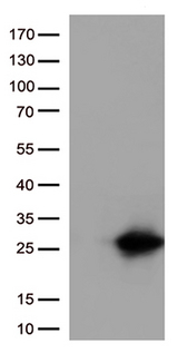CTAG1B / NY-ESO-1 Antibody - HEK293T cells were transfected with the pCMV6-ENTRY control. (Left lane) or pCMV6-ENTRY CTAG1B. (Right lane) cDNA for 48 hrs and lysed. Equivalent amounts of cell lysates. (5 ug per lane) were separated by SDS-PAGE and immunoblotted with anti-CTAG1B. (1:500)