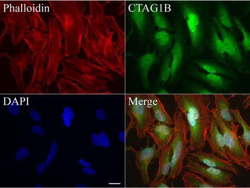 CTAG1B / NY-ESO-1 Antibody - Immunofluorescent staining of HeLa cells using anti-CTAG1B mouse monoclonal antibody  green, 1:50). Actin filaments were labeled with Alexa Fluor® 594 Phalloidin. (red), and nuclear with DAPI. (blue). Scale bar, 20µm.