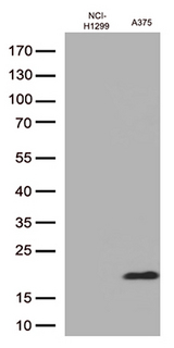 CTAG1B / NY-ESO-1 Antibody - Western blot analysis of extracts. (35ug) from 2 cell lines lysates by using anti-CTAG1B monoclonal antibody. (1:500)