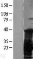 CTAG1B / NY-ESO-1 Protein - Western validation with an anti-DDK antibody * L: Control HEK293 lysate R: Over-expression lysate