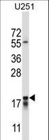 CTAG2 Antibody - CTAG2 Antibody western blot of U251 cell line lysates (35 ug/lane). The CTAG2 antibody detected the CTAG2 protein (arrow).