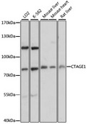 CTAGE1 / CTAGE Antibody - Western blot analysis of extracts of various cell lines, using CTAGE1 antibody at 1:3000 dilution. The secondary antibody used was an HRP Goat Anti-Rabbit IgG (H+L) at 1:10000 dilution. Lysates were loaded 25ug per lane and 3% nonfat dry milk in TBST was used for blocking. An ECL Kit was used for detection and the exposure time was 1s.