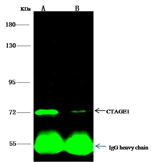 CTAGE1 / CTAGE Antibody - CTAGE1 was immunoprecipitated using: Lane A: 0.5 mg 293T Whole Cell Lysate. Lane B: 0.5 mg Hela Whole Cell Lysate. 0.5 uL anti-CTAGE1 rabbit polyclonal antibody and 15 ul of 50% Protein G agarose. Primary antibody: Anti-CTAGE1 rabbit polyclonal antibody, at 1:500 dilution. Secondary antibody: Dylight 800-labeled antibody to rabbit IgG (H+L), at 1:5000 dilution. Developed using the odssey technique. Performed under reducing conditions. Predicted band size: 85 kDa. Observed band size: 85 kDa.