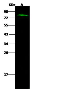 CTAGE1 / CTAGE Antibody - Anti-CTAGE1 rabbit polyclonal antibody at 1:500 dilution. Lane A: MDA-MB453 Whole Cell Lysate. Lysates/proteins at 30 ug per lane. Secondary: Goat Anti-Rabbit IgG H&L (Dylight 800) at 1/10000 dilution. Developed using the Odyssey technique. Performed under reducing conditions. Predicted band size: 85 kDa. Observed band size: 85 kDa.