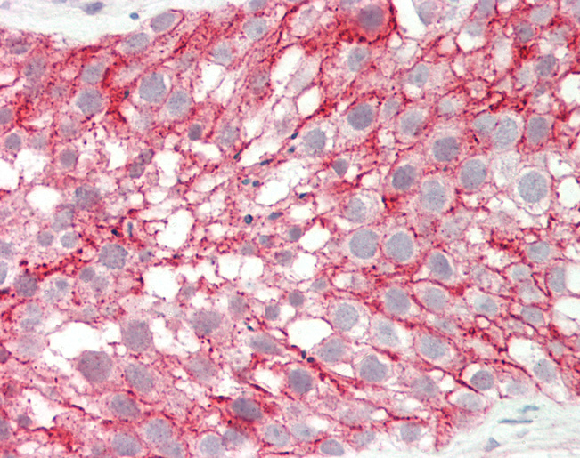 CTAGE5 Antibody - Human Testis: Formalin-Fixed, Paraffin-Embedded (FFPE).  This image was taken for the unconjugated form of this product. Other forms have not been tested.
